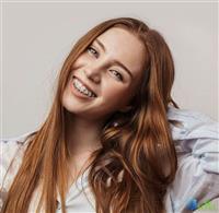 Niềng răng mắc cài sứ bao nhiêu tiền?