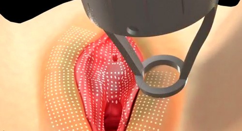 Cách để cô bé hồng hào