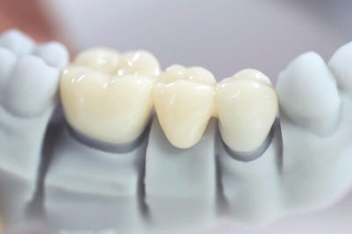 Tuoi tho cua Boc rang su co the len toi 25 nam